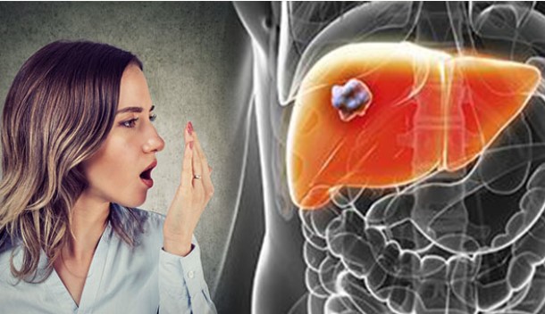 3 bộ phận trên cơ thể ‘bốc mùi’, chứng tỏ gan bị tổn thương đang chuyển thành ung thư