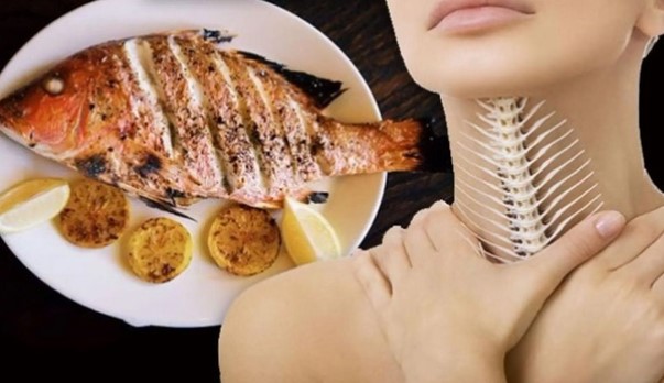 Bị hóc xương cá, xương gà nên xử trí ra sao để không gặp nguy hiểm?