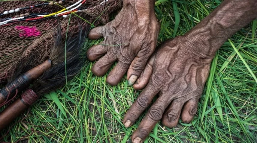 Những bàn tay cụt ngón của bộ tộc Dani. Ảnh: Grunge.