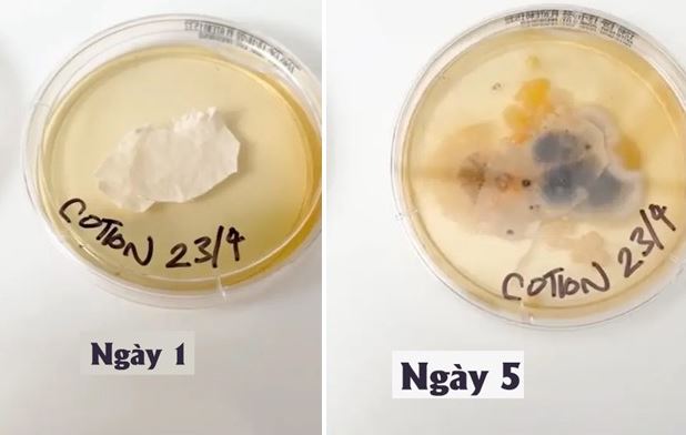 Món đồ trên giường bẩn hơn bồn cầu gấp 17.000 lần, có thể gây viêm màng não, viêm phổi nếu không làm 1 việc