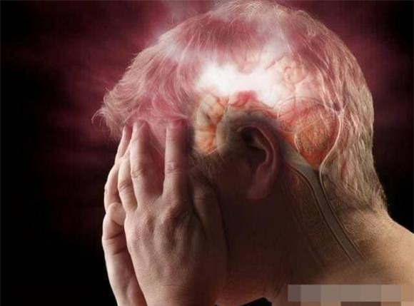 nhoi-mau-nao (1).jpg 1 nhồi máu não, tai biến mạch máu não, sức khỏe, gia vị gây hại