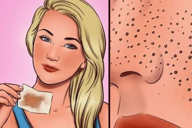 8 sai l&#x1EA7;m khi ch&#x103;m s&#xF3;c da khi&#x1EBF;n l&#x1ED7; ch&#xE2;n l&#xF4;ng n&#x1EDF; to