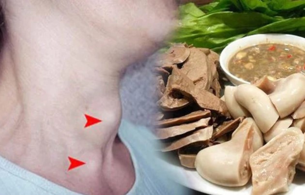 Người bị ung thư tuyến giáp không nên ăn gì để bệnh không chuyển nặng?