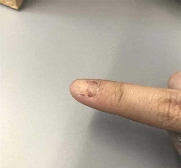 rut-mong (1).jpeg 1 móng tay, phi hành gia, vũ trụ