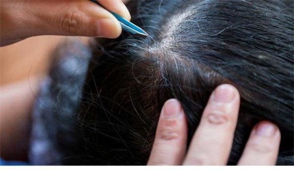 nhổ tóc bạc 1 tóc bạc, nhổ tóc bạc, khỏe đẹp