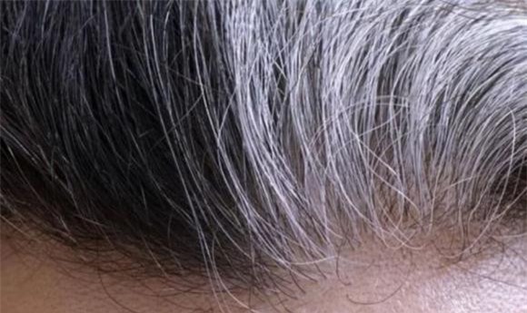 nhổ tóc bạc 0 tóc bạc, nhổ tóc bạc, khỏe đẹp