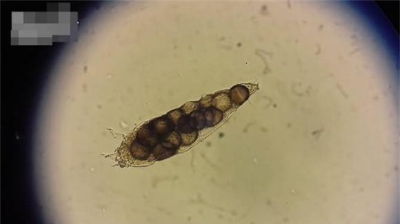 Demodex (1).jpg 1 nang Demodex, ký sinh, phát hiện mới, loài ve Demodex
