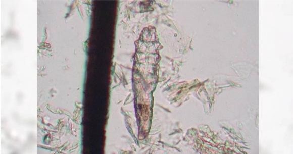 4.jpg 3 nang Demodex, ký sinh, phát hiện mới, loài ve Demodex