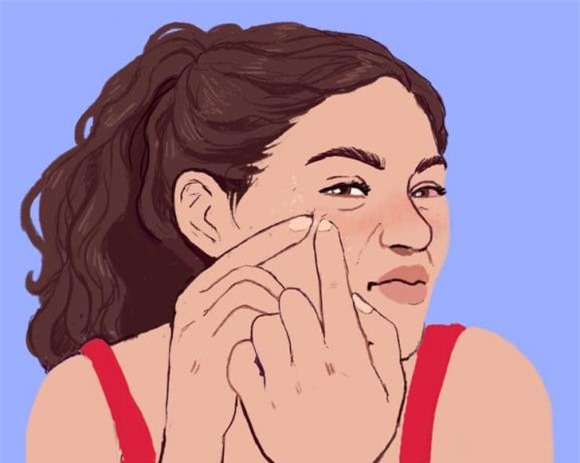 mụn trắng, mụn trắng ở gần mắt, sức khỏe 