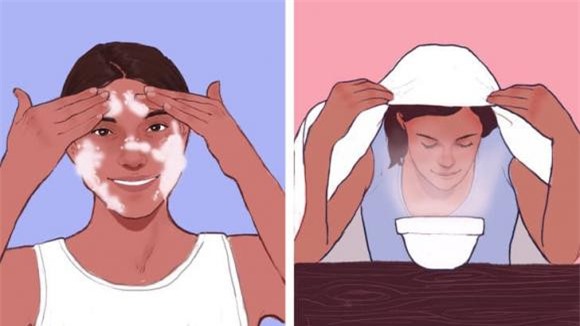 mụn trắng, mụn trắng ở gần mắt, sức khỏe 