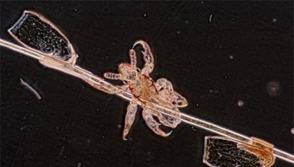 chay (1).jpeg 3 chấy, rận, sinh vật