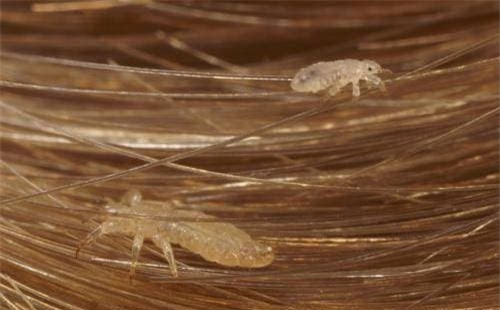 chay (1).jpeg 5 chấy, rận, sinh vật