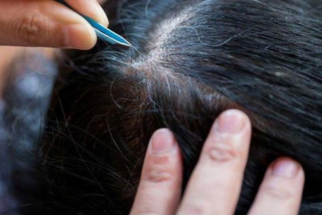 3 lý do tại sao không nên nhổ tóc bạc?