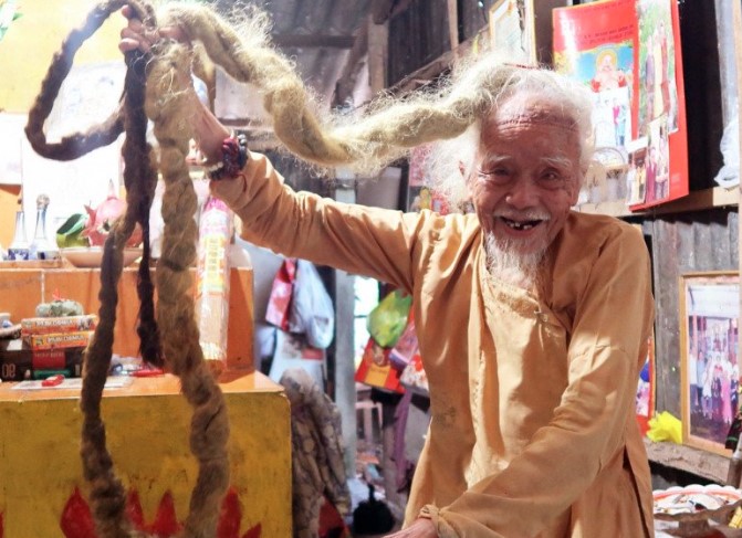 3 người đàn ông Việt sở hữu mái tóc trông rất kỳ dị, suốt nhiều năm không dám cắt bỏ vì điều này