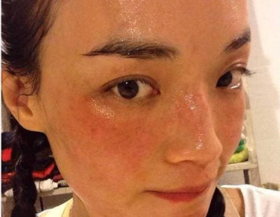 Tại sao phụ nữ thường xuyên làm đẹp lại có làn da xấu nhất? Nhiều người làm sai 3 điều này, đặc biệt là điều đầu tiên