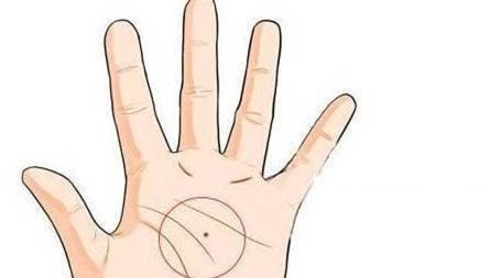 not-ruoi-tren-tay (1).jpeg 1 xem tướng, nốt ruồi, vị trí nốt ruồi, nốt ruồi trên bàn tay