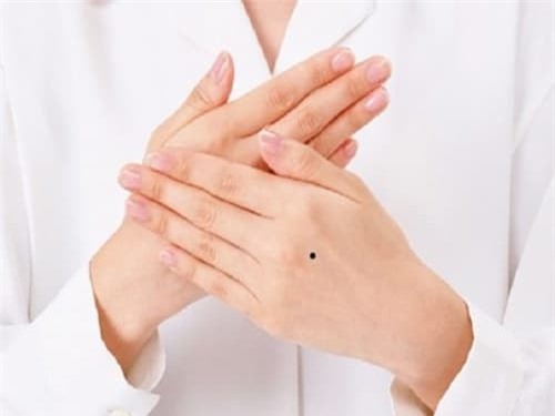 mep.jpg 1 xem tướng, nốt ruồi, vị trí nốt ruồi, nốt ruồi trên bàn tay