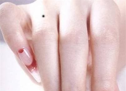 not-ruoi-tren-tay (1).jpeg 5 xem tướng, nốt ruồi, vị trí nốt ruồi, nốt ruồi trên bàn tay