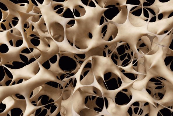 Một miếng tương đương với việc uống hết 10 ly rượu! Không muốn xương bị ăn mòn và 'thối rữa', hãy ăn càng ít càng tốt món '1 đen và 1 xanh' này