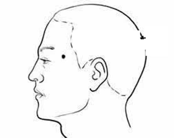 Nốt ruồi ở những vị trí này là nơi dễ kiếm tiền nhất, và đều ẩn chứa những điều bí ẩn