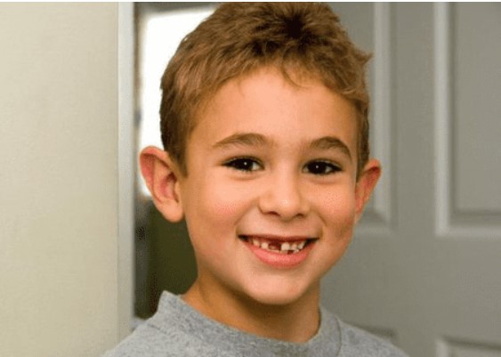 Tại sao con người chỉ mọc răng hai lần?