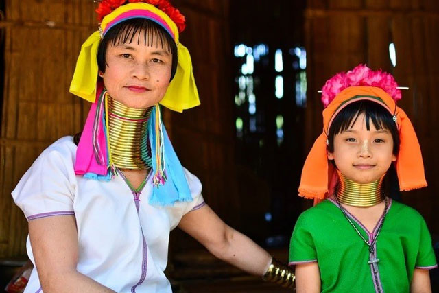 Những tiêu chuẩn sắc đẹp kỳ lạ ở các nước châu Á