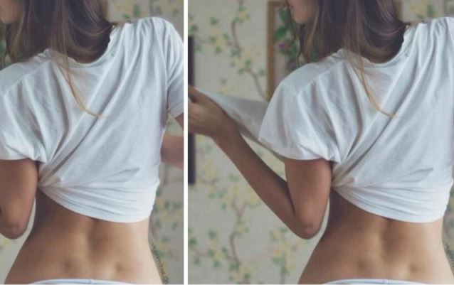 2 lúm đồng tiền sau lưng không chỉ là biểu tượng của sự gợi cảm mà còn là dấu hiệu tiết lộ tình trạng sức khỏe