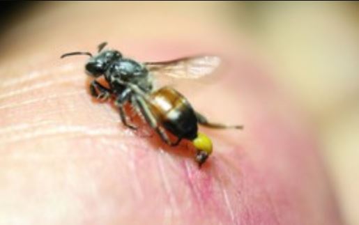 Vì sao trẻ dễ bị côn trùng 'tấn công'? Bác sĩ lý giải