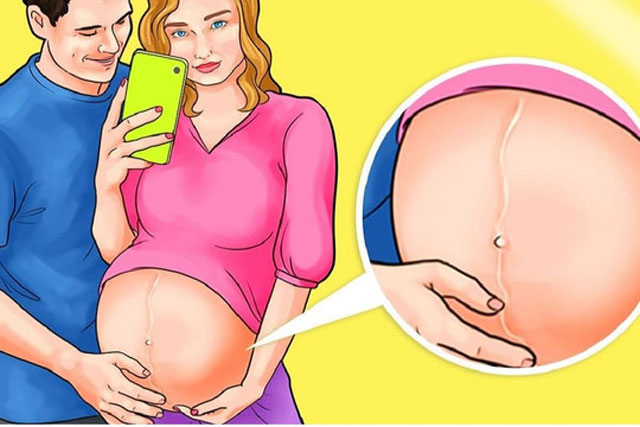 Giải mã đường sọc nâu mẹ bầu nào cũng có trên bụng khi mang thai. Đường này xuất hiện có ảnh hưởng đến thai kỳ của mẹ không