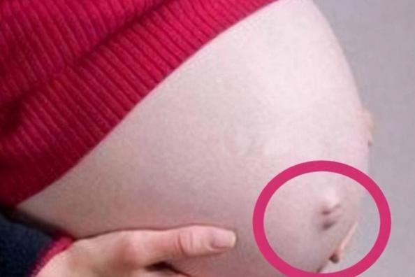 Tại sao rốn của phụ nữ mang thai lại lồi? Có liên quan đến việc sinh con trai, con gái không?