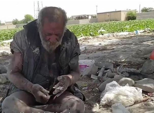 Các nhà khoa học bối rối trước 'sức khỏe hoàn hảo' của cụ ông vô gia cư 87 tuổi, ăn uống thực phẩm bẩn và không bao giờ tắm