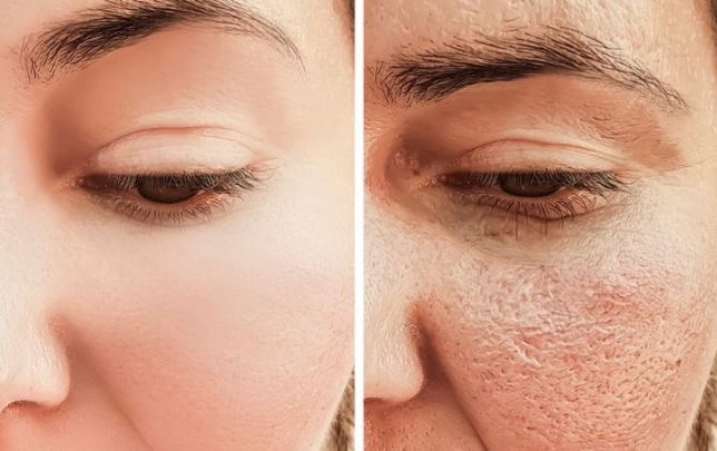 Loại gia vị này là kẻ thù nhan sắc khiến chị em bị lỗ chân lông to và tăng cân, hạn chế ăn sẽ có lợi rất nhiều