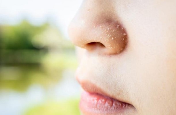 Hiện tượng 'gàu quanh mũi' là gì? Có nguy hiểm không? Và điều chúng ta ít biết về cơ thể mình!