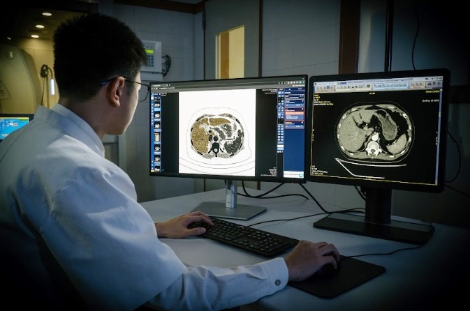 Ứng dụng AI trong điều trị ung thư, lao phổi