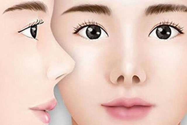 Nh&#xE2;n t&#x1B0;&#x1EDB;ng h&#x1ECD;c: M&#x169;i h&#x1EBF;ch, 1 trong 5 n&#xE9;t t&#x1B0;&#x1EDB;ng c&#x1EE7;a ph&#x1EE5; n&#x1EEF; kh&#x1ED5; v&#xEC; t&#xEC;nh