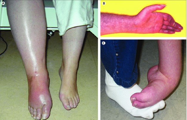 Điều đau đớn nhất trên thế giới là gì? Có thể chữa khỏi căn bệnh quái ác này không?