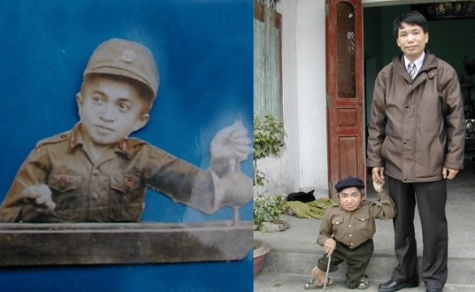 Việt Nam từng có người lùn nhất lịch sử nhân loại: 18 tuổi mới tập đi, suýt giành kỷ lục Guinness