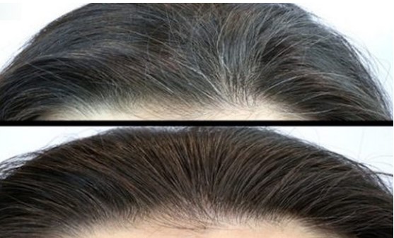 Khế giã nhuyễn trộn cùng nước dừa bôi lên đầu: Tóc xơ rối, bạc trắng cũng đen mượt như suối