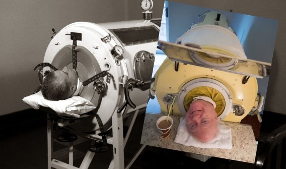 Danh tính người đàn ông sống trong 'lá phổi sắt' lâu nhất lịch sử con người lập Kỷ lục Guinness