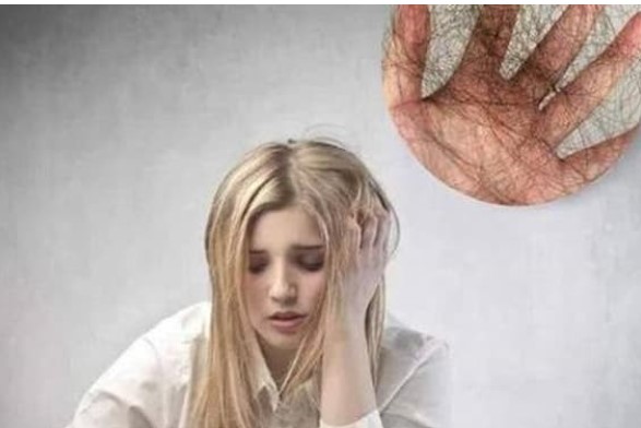 Tại sao một số người luôn rụng tóc, rất nhiều cùng một lúc? Không ngờ, thủ phạm hóa ra lại là 'nó'