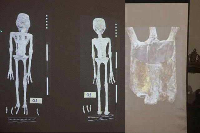 Phát hiện bí mật bên trong ‘xác ướp người ngoài hành tinh’ ở Peru, chuyên gia tuyên bố gây choáng