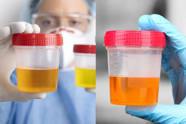 Tại sao nước tiểu của con người lại có màu vàng thay vì các màu sắc khác?