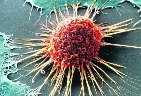 8 dấu hiệu cảnh báo khối u: Chuyên gia dặn có 1 cũng phải đi khám