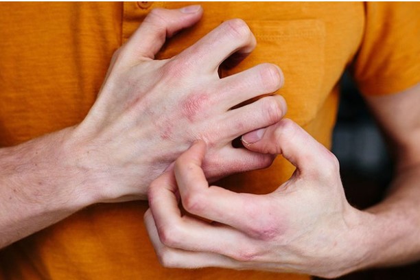 Người có đường huyết cao sẽ có 3 dấu hiệu này trên da: Muốn đường huyết ổn định phải tuân thủ 4 quy tắc này