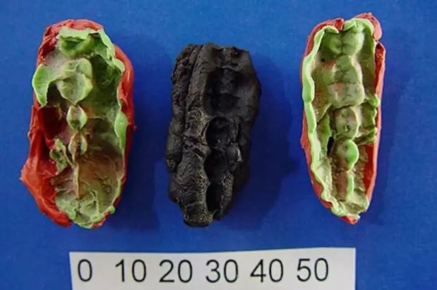 'Kẹo cao su' 10.000 năm tuổi tiết lộ sức khoẻ răng miệng của cư dân thời đồ đá