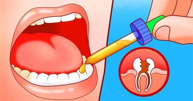 cách chữa đau răng ngay tại nhà  4