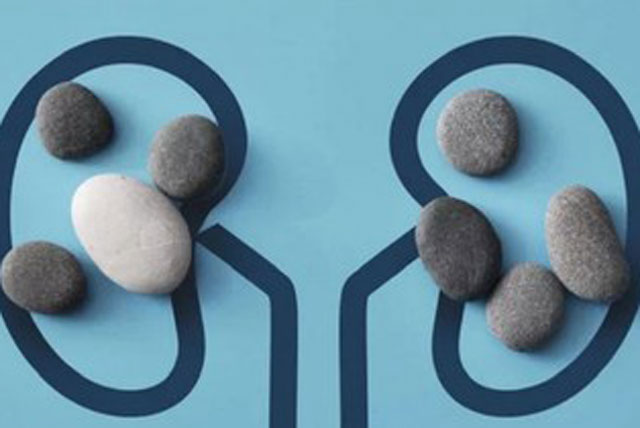 Clip: Sỏi thận hình thành như thế nào?