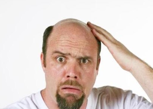Đàn ông thường hói đầu còn phụ nữ thì hiếm khi, lý do hóa ra liên quan đến điểm này