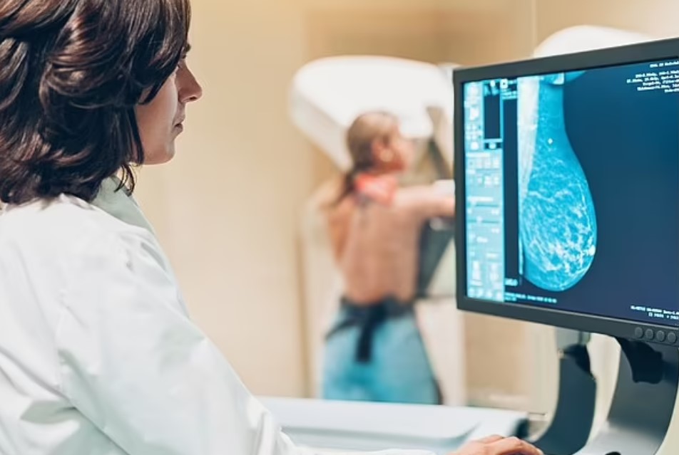 Công nghệ AI mới giúp bệnh nhân ung thư vú chẩn đoán tác dụng phụ sau điều trị