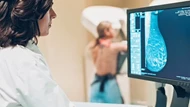 Công nghệ AI mới giúp bệnh nhân ung thư vú chẩn đoán tác dụng phụ sau điều trị